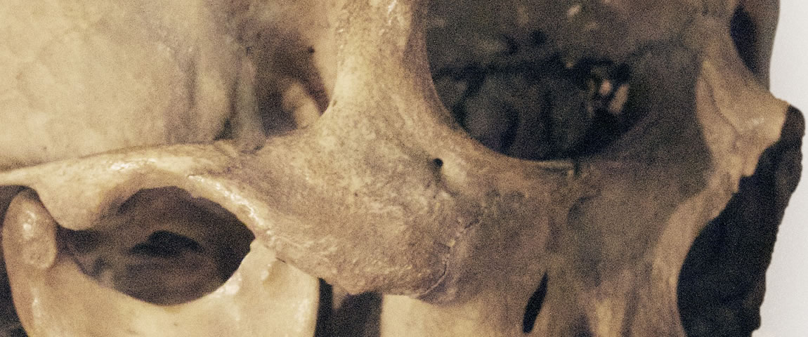 originate · Foto Retusche Schädel